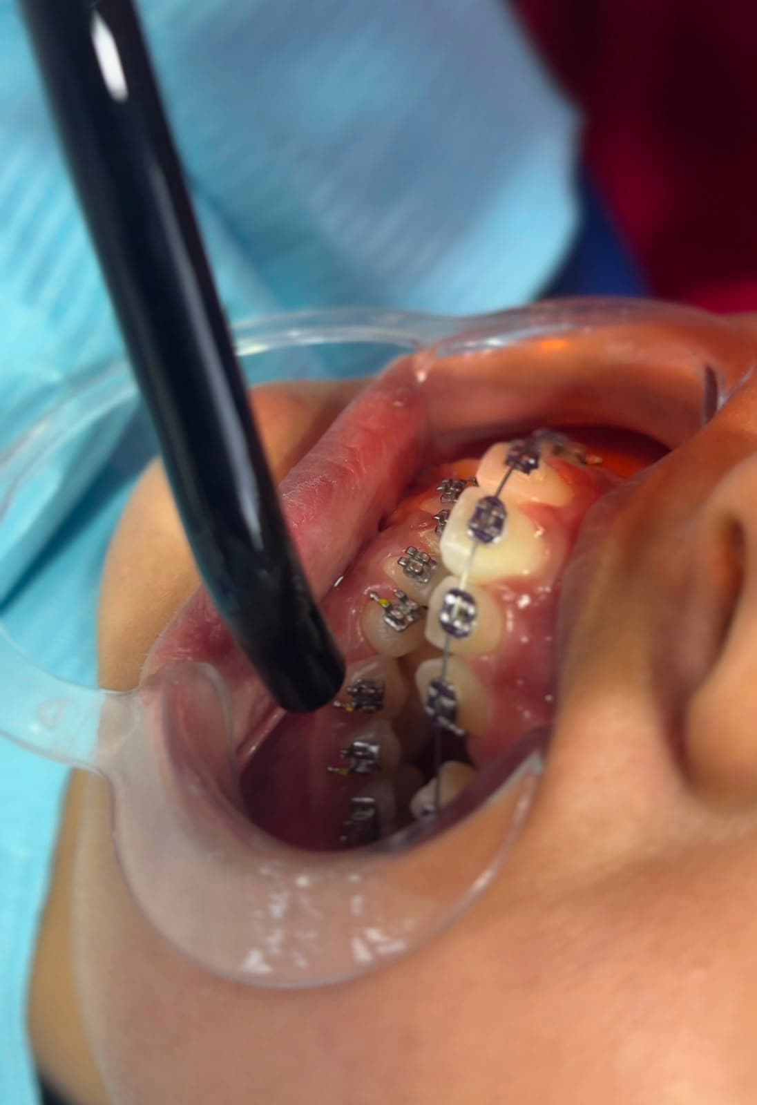 Clinic Experience at Kripa Dental Clinic Bharatpur Chitwan